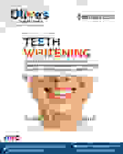 Want Whiter Teeth? Best Teeth Whitening in Madhapur Now